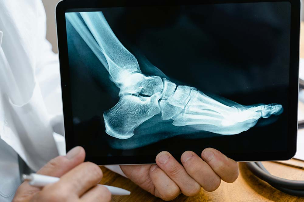 A doctor holding a tablet that displays a foot X-ray used as evidence in a Dorchester County workers’ comp case in SC