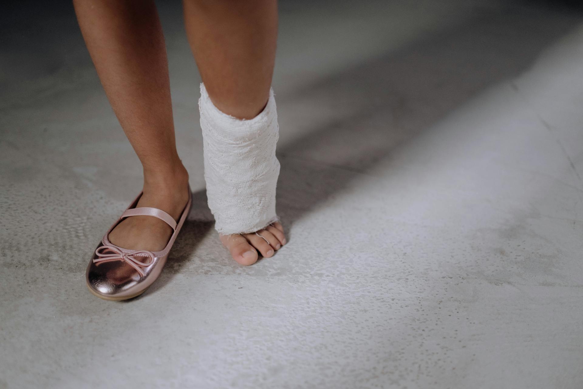 A child’s feet with one injured shin in a cast